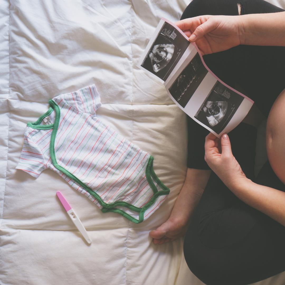 Pregnant woman with sonogram